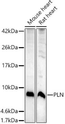 Western Blot: Phospholamban AntibodyAzide and BSA Free [NBP2-94385]